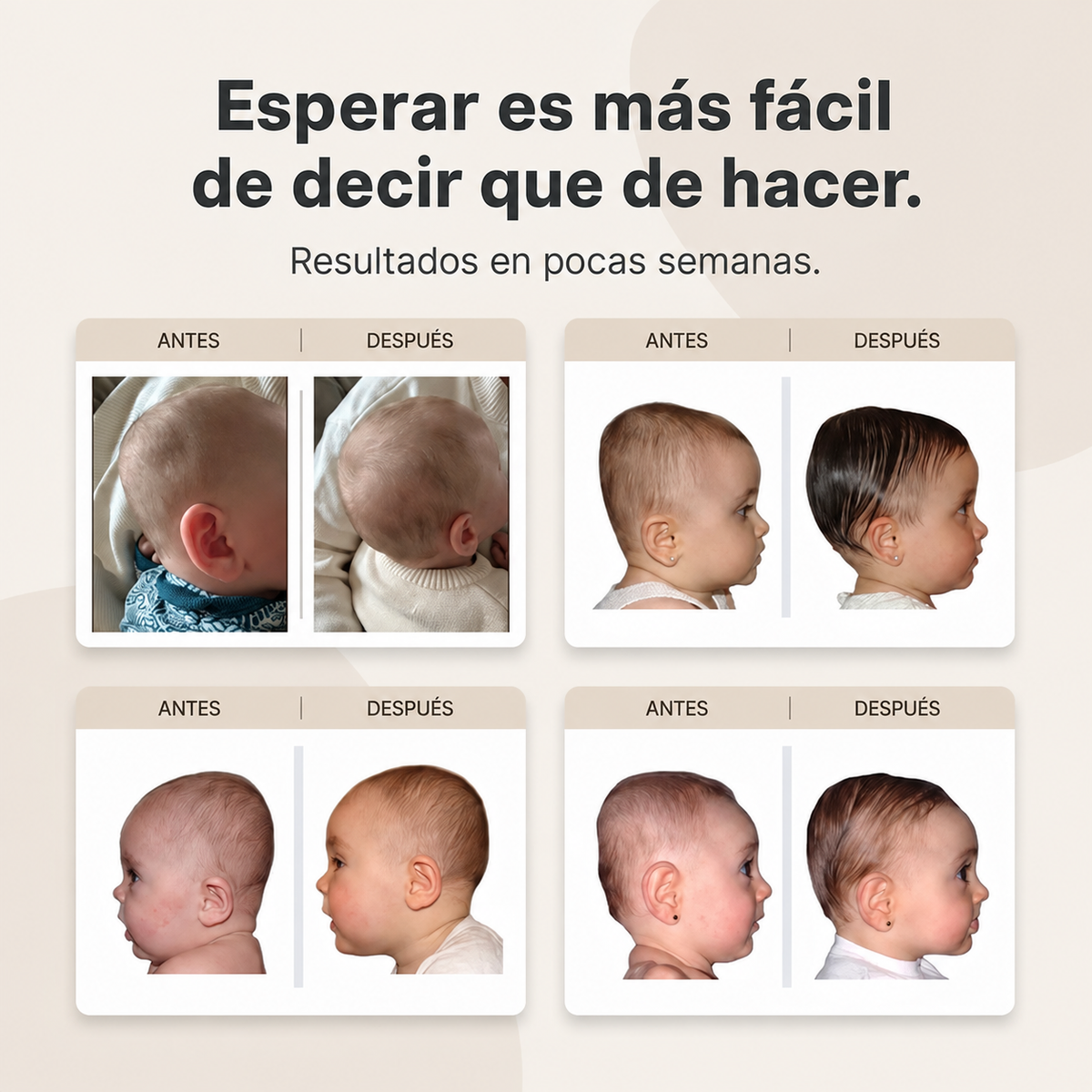 Flexoriom Baby™ — Cojín de Posicionamiento contra la Cabeza Plana
